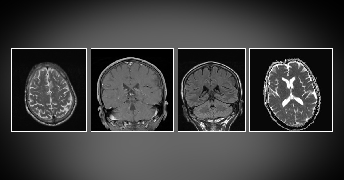 Spot The Diagnosis