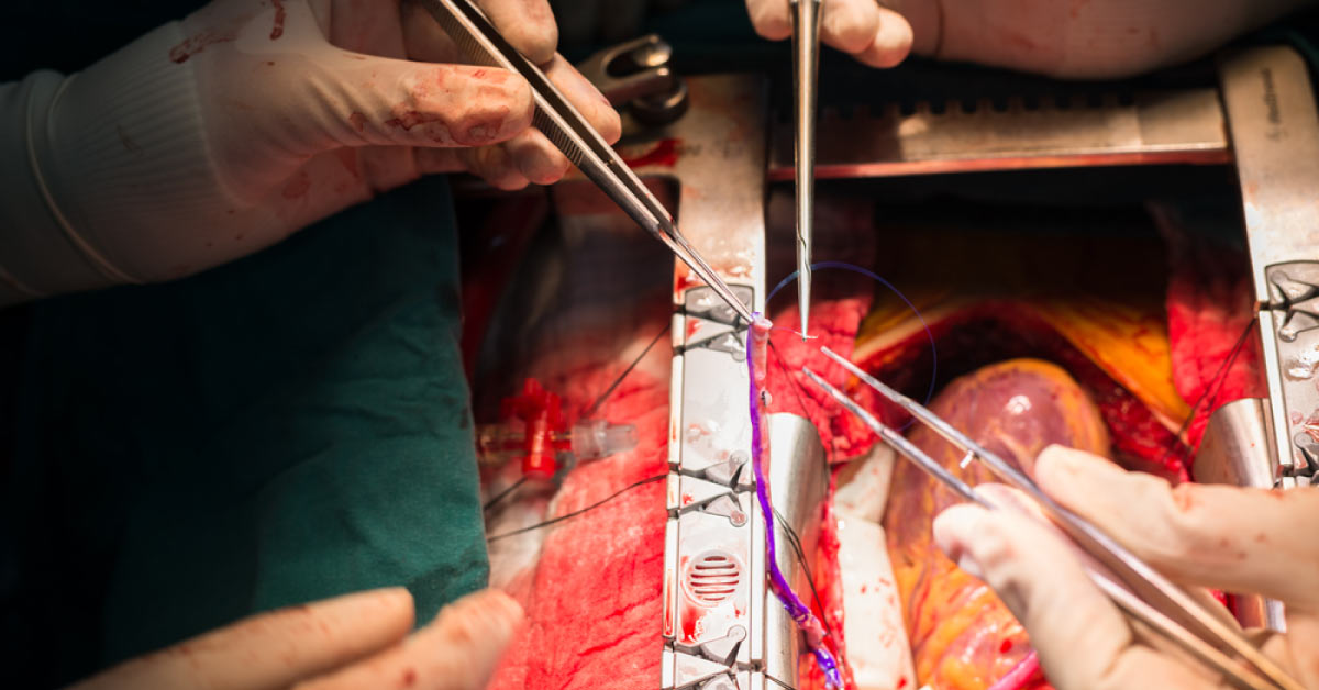 Superiority Of Surgery Over Stent In The Long Term Proved Conclusively