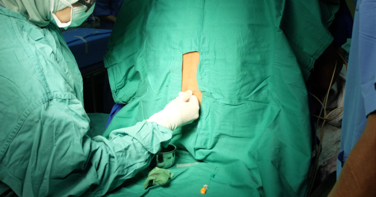 Factors Affecting Spread Of Local Anesthetic In Epidural Space And Anesthesiologists Questions For Patients With Epidural Block