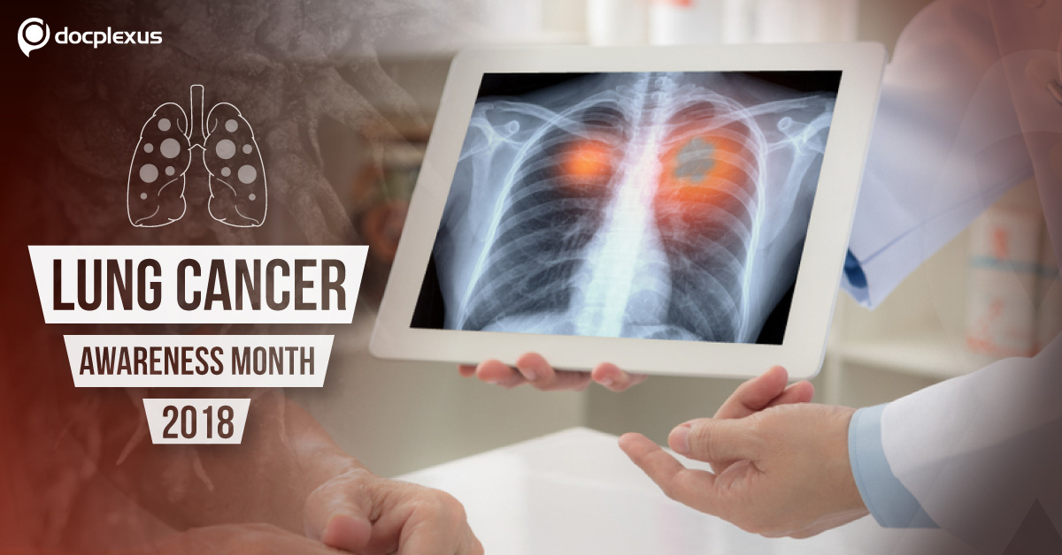 Lung Cancer: Screening Is Survival