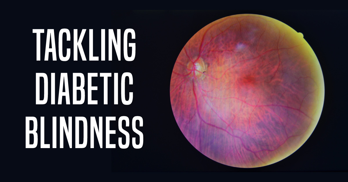 World Diabetes Day, November 14 2018: How to Prevent Diabetic Blindness?