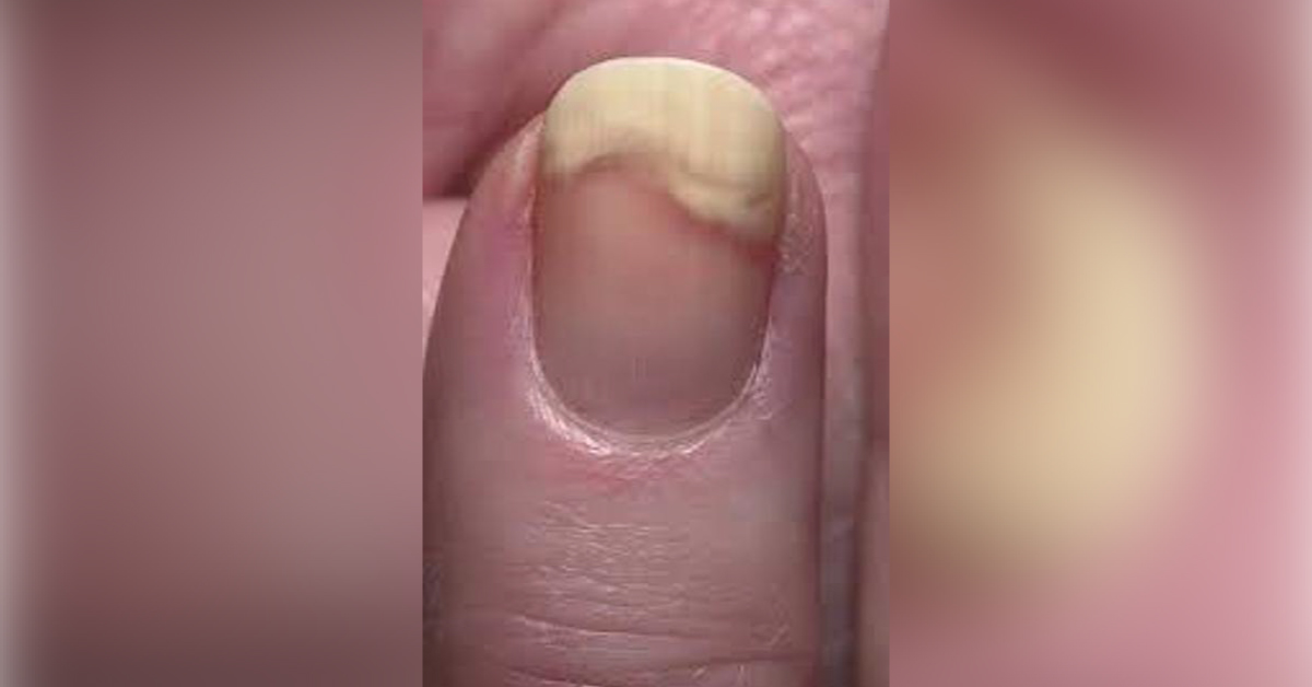 Spot The Diagnosis