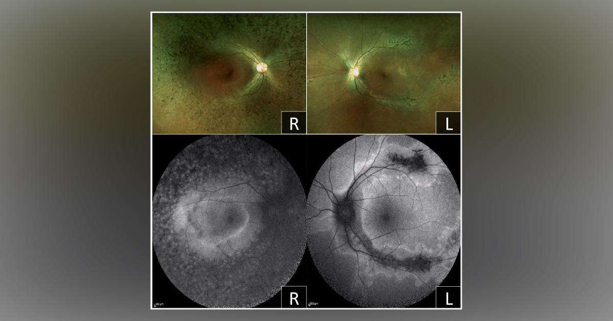 Diagnose This Patient's Condition