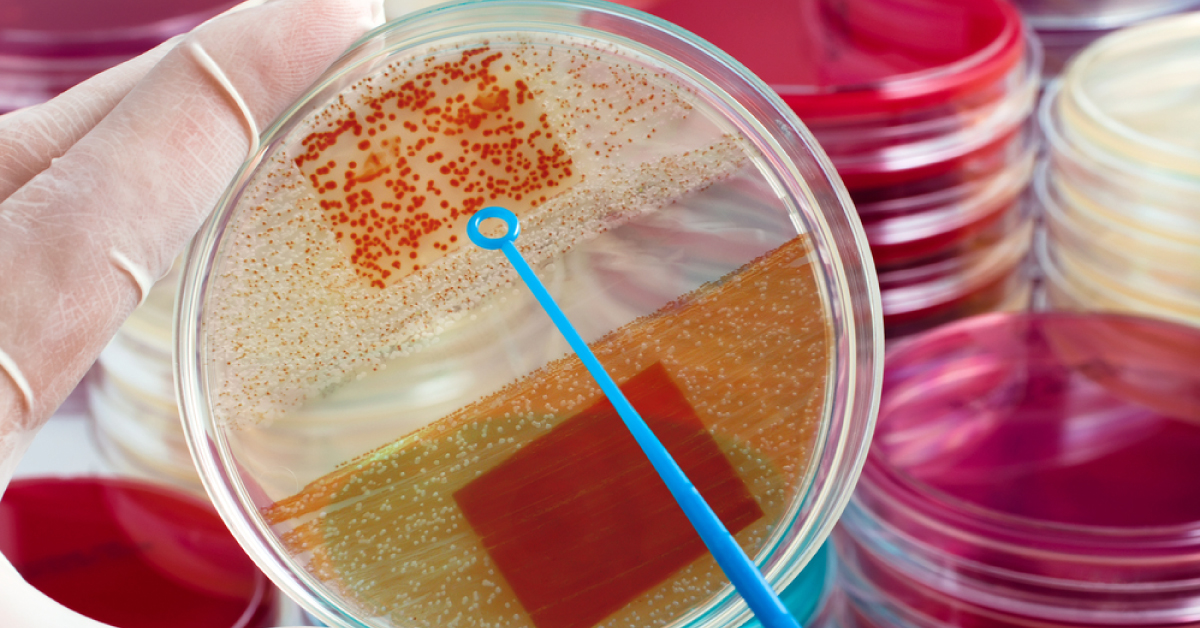 Microbes Found In International Space Centre- A New Resistant Non-pathogenic Variety Of Genome