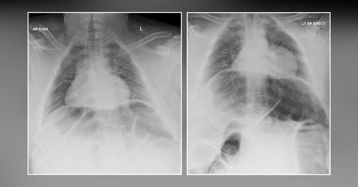 Diagnose This Male with no Bowel Opening