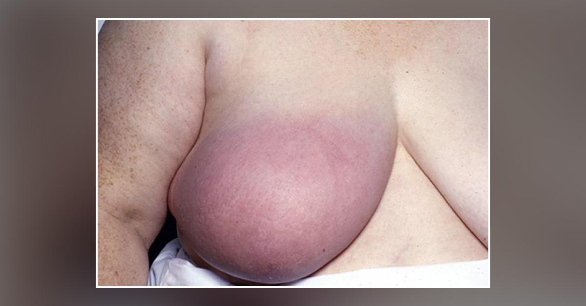 Diagnose The Disease