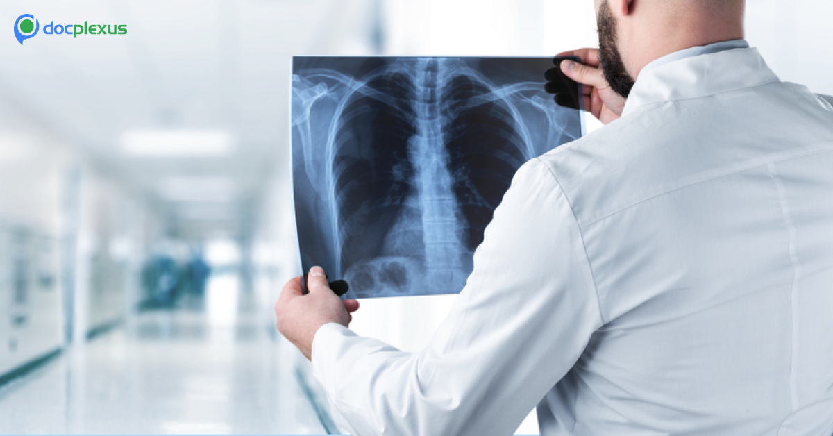 Appropriate Factors for Chest Radiography