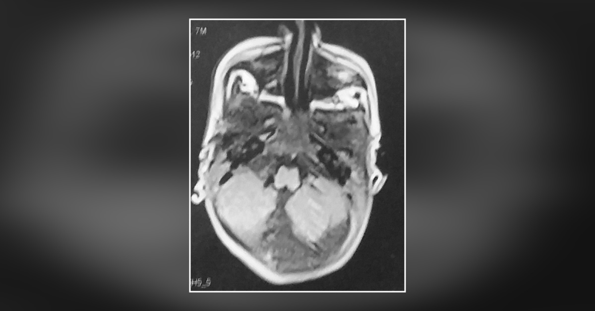 Can You Diagnose This Condition?
