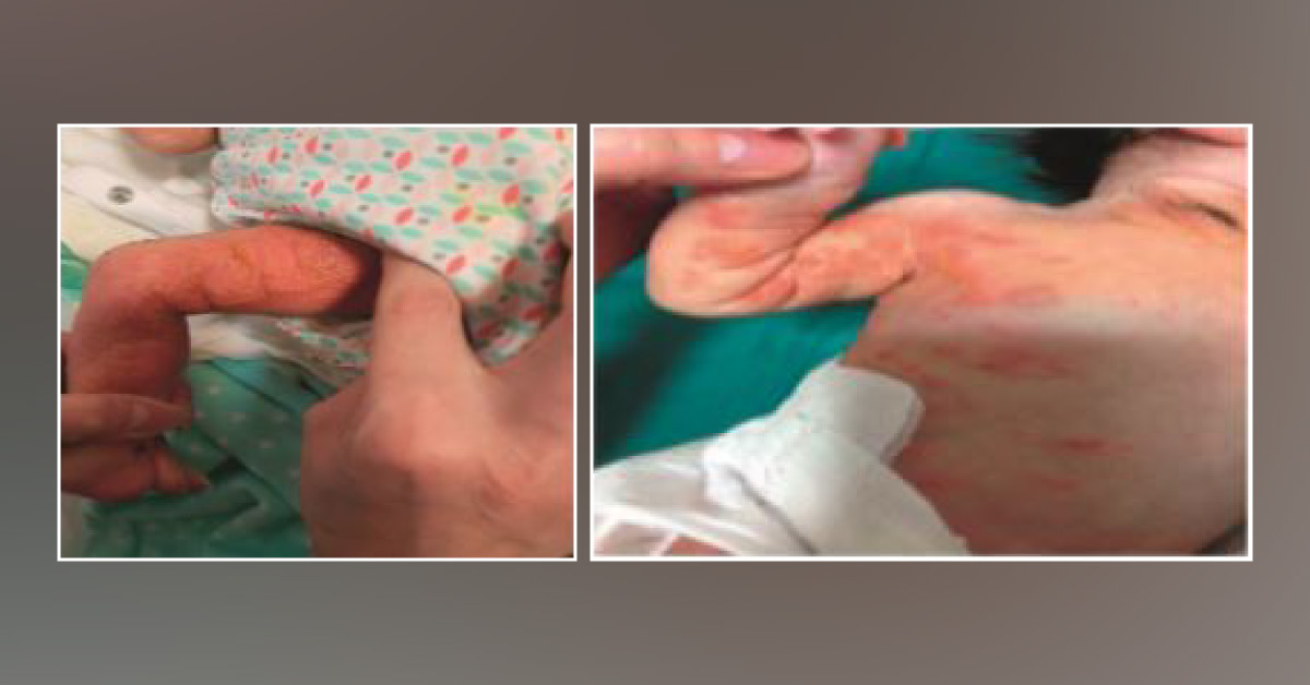 Diagnose the Disease from the Skin Lesions and Histopathological Images