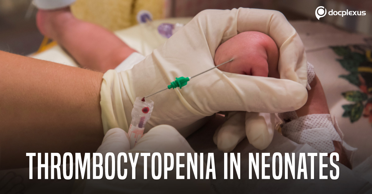 Neonatal Thrombocytopenia