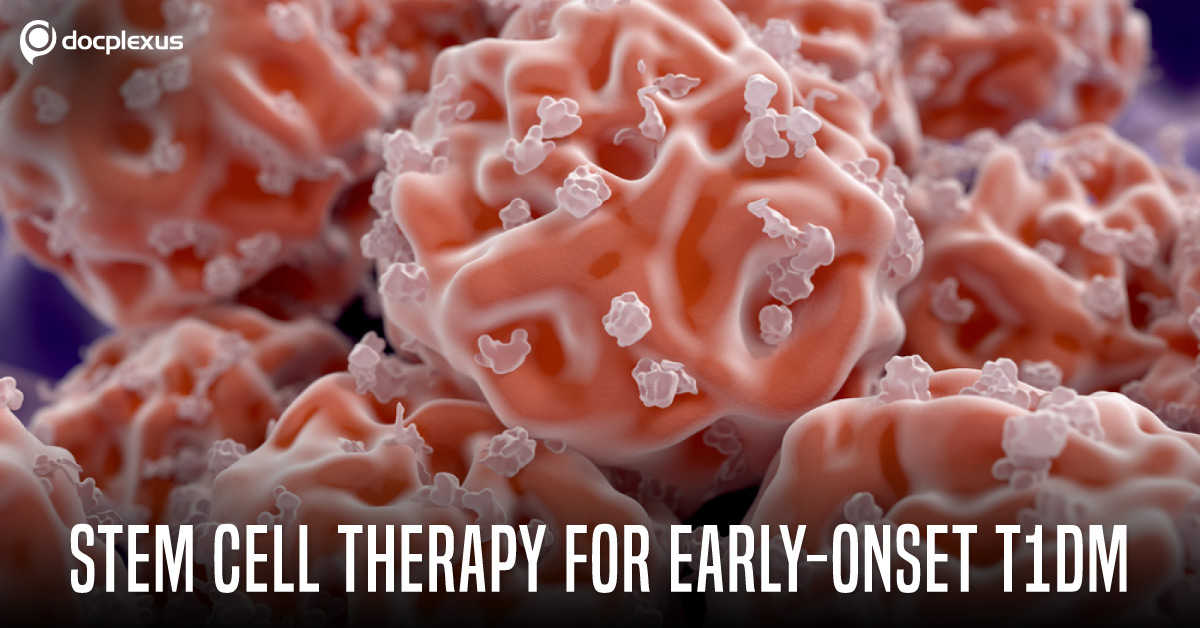 Clinical Translation Of Stem Cell Therapy For Diabetes Management