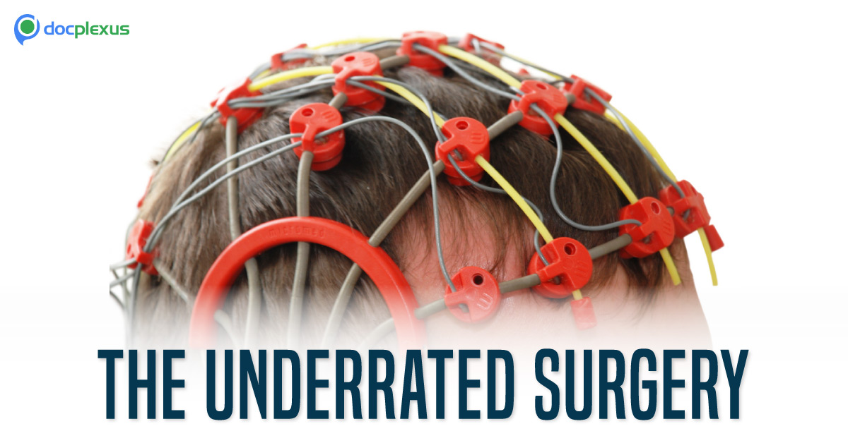 Epilepsy Surgery: An Underutilized Procedure