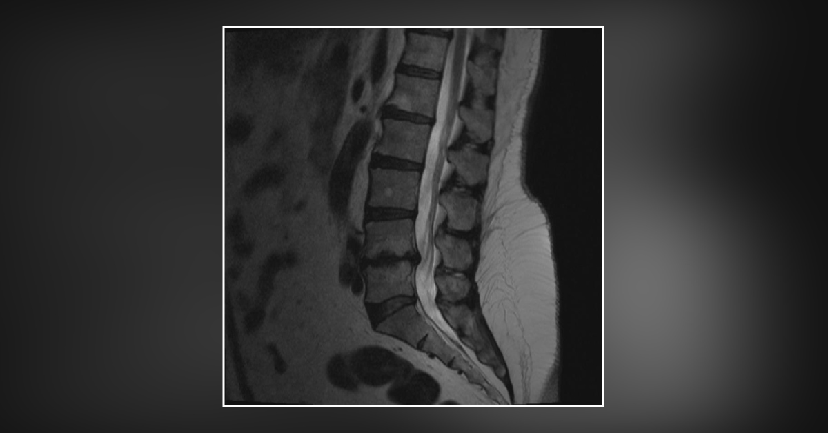 Diagnose This Woman With Pain In Leg