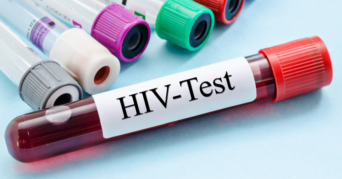Pre-exposure Prophylaxis (PrEP) For HIV Exposed Or Risky Persons