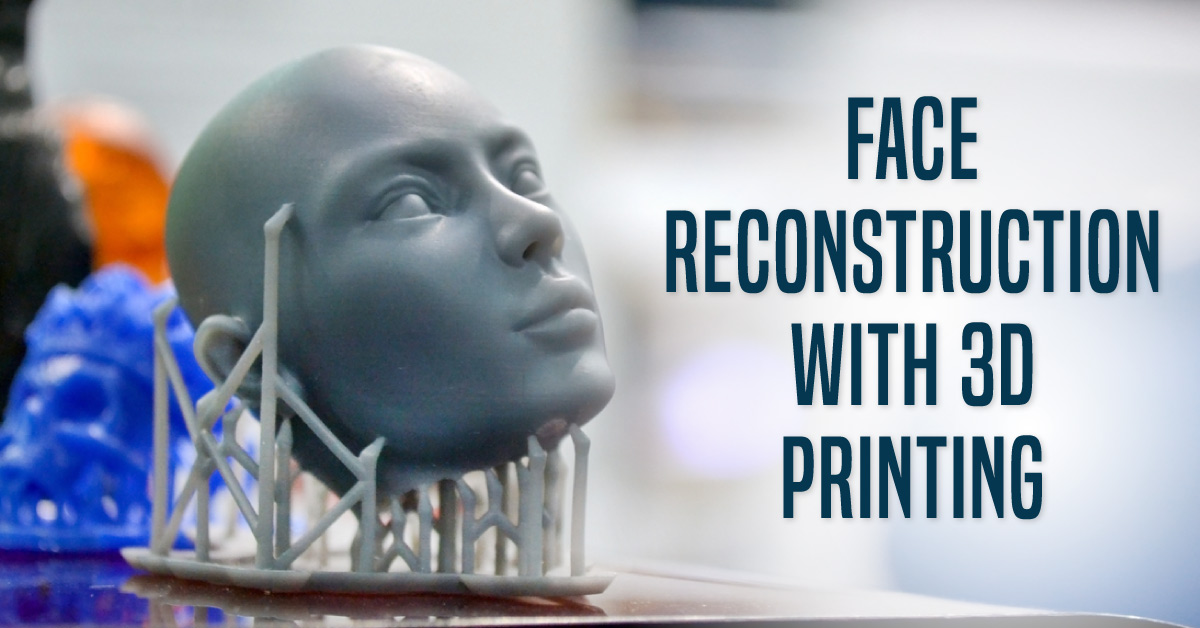 3D Printing Technology In Face Restoration