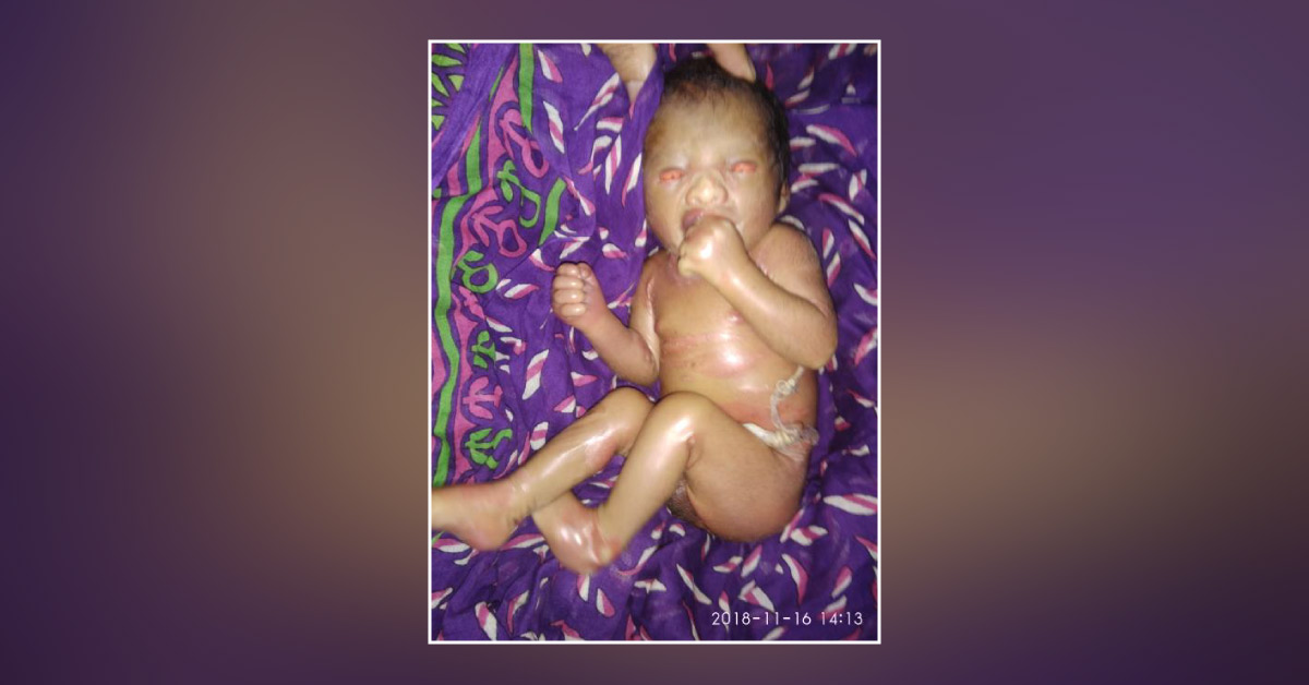 What Should Be The Diagnosis In This Newborn Case