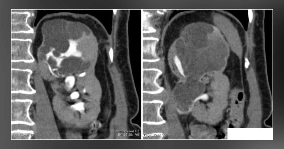 Interpret These Radiologic Findings
