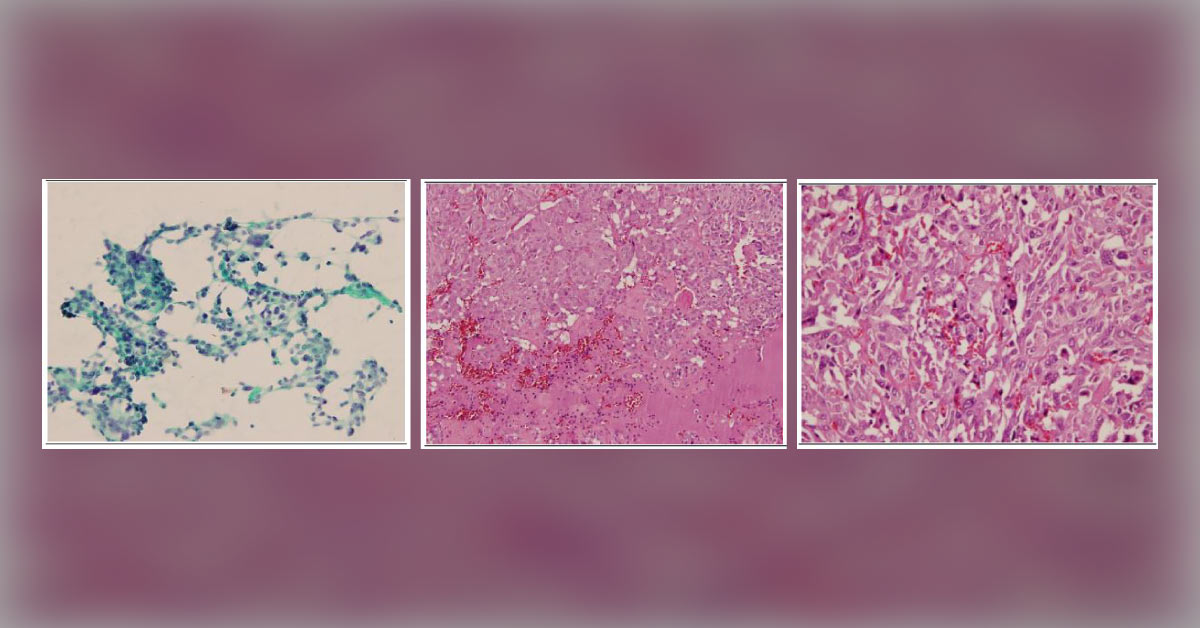 Diagnose Based on Histopathological Examinations