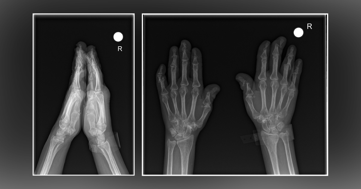 Diagnose This Condition