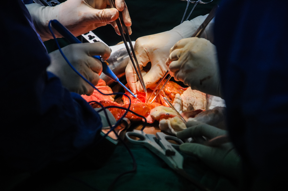 In India, First Successful Liver Transplant Receipient Is Now A Doctor