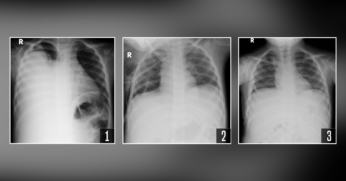 Suggest the Differential Diagnosis