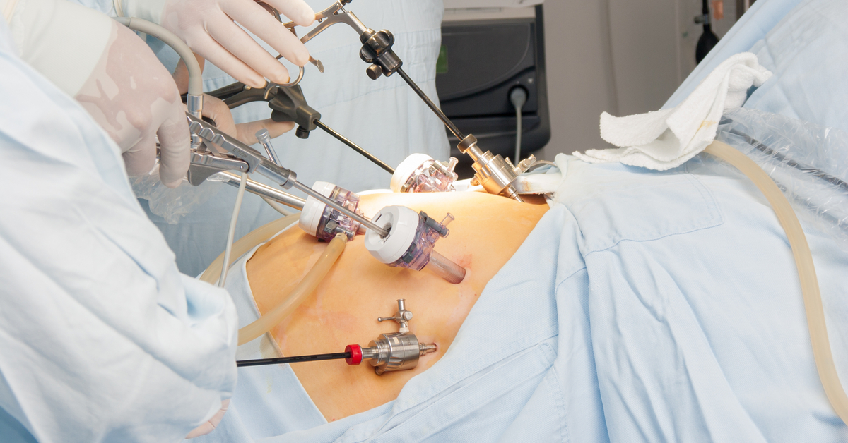 Fighting Obesity With Surgery May Prevent Risk of Kidney Disease