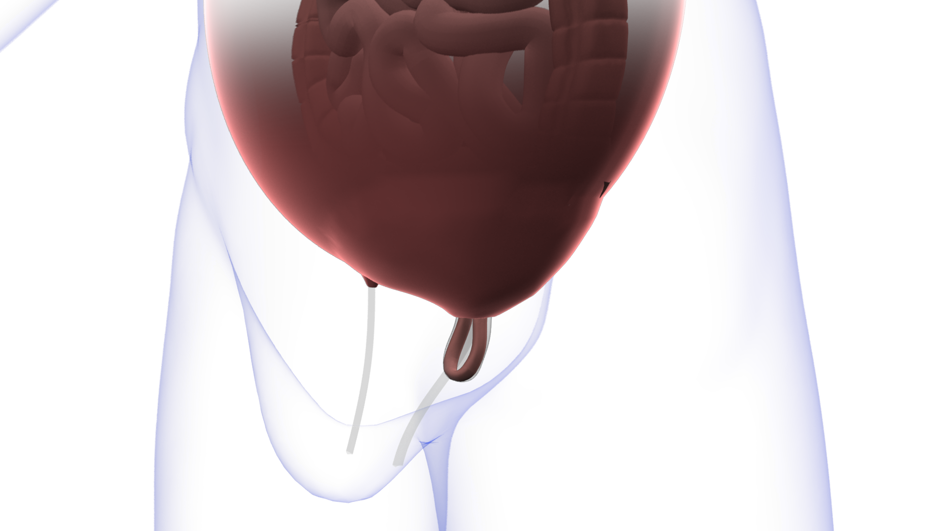 Why The Type And Quality Of Hernia Surgery Is Crucial!