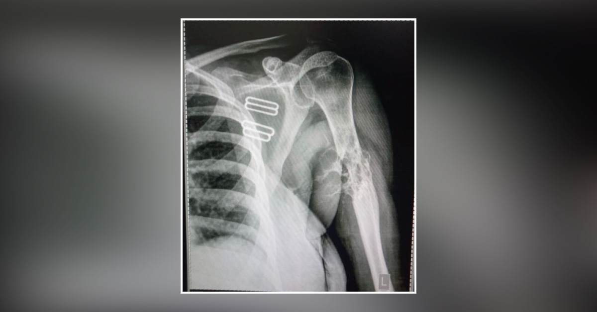 Diagnose This Active Female