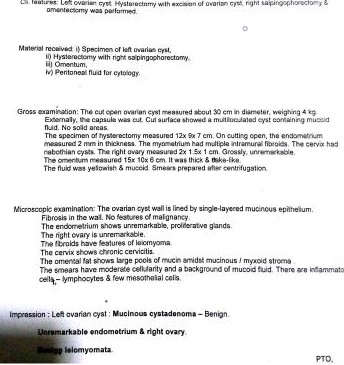 Case Of Pseudomyxoma Peritonei