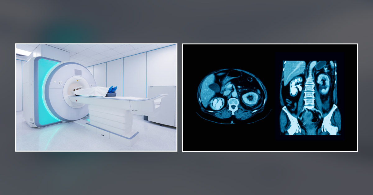 CT Vs MRI: Which One Is Right For You?