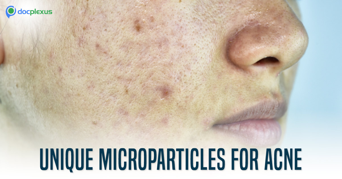 US FDA Approves Unique Microparticles For Treatment of Acne