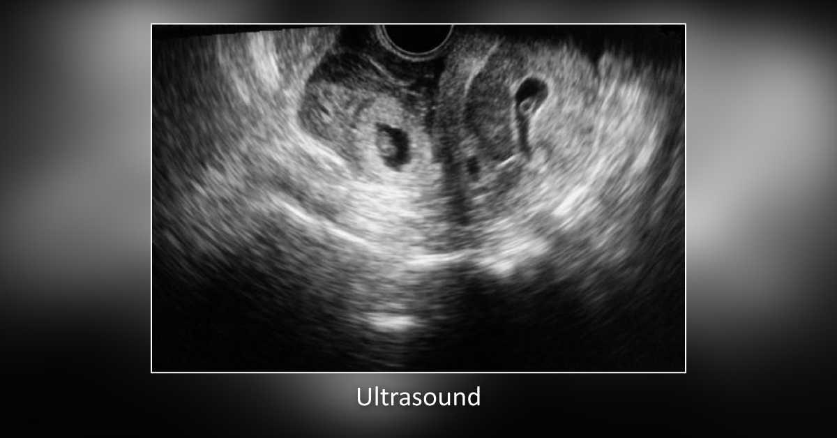 Solve This Clinical Case