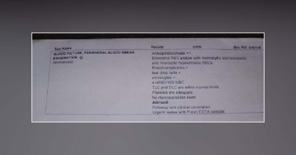 Opinion On The  Blood Report Of 18 Months Old