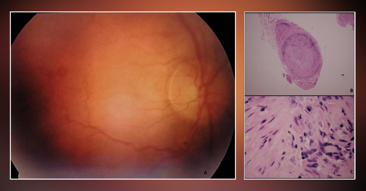Diagnose This Elderly Woman