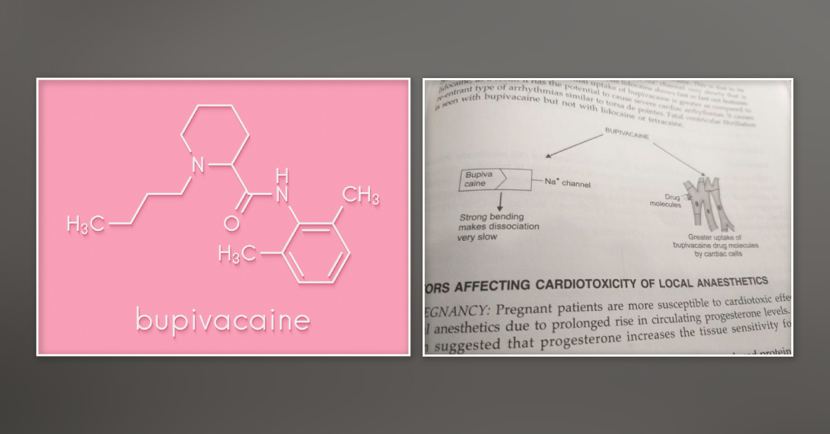 Why Bupivacaine Is More Cardiotoxic Than Lidocaine