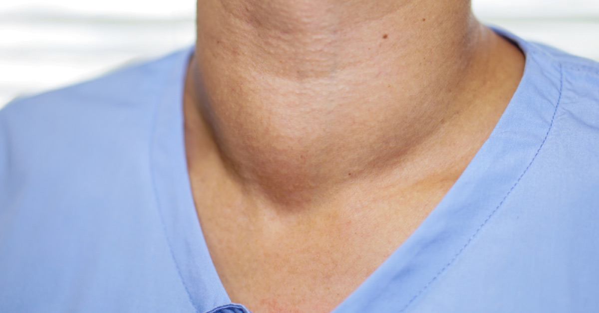 Does Bigger Thyroid Nodules Always Mean Bad?