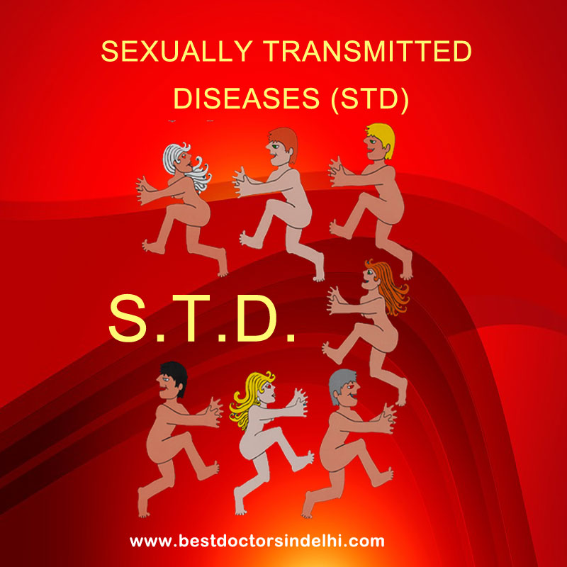 Sexually Transmitted Diseases