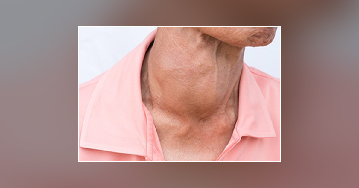 Spot The Diagnosis