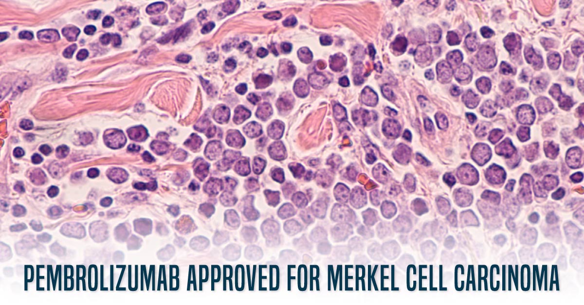 US FDA Approves Pembrolizumab For Merkel Cell Carcinoma