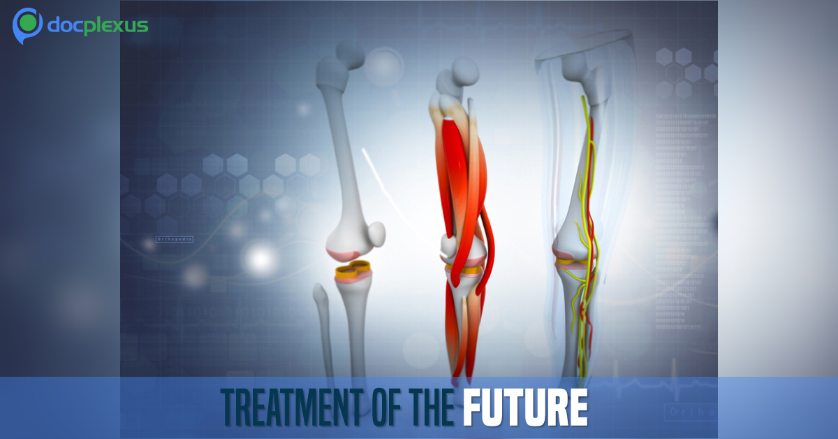 Platelet Rich Plasma: New Treatment Intervention For Osteoarthritis