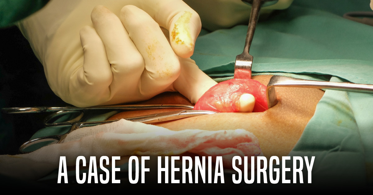 A Man in His 50s with Hernia