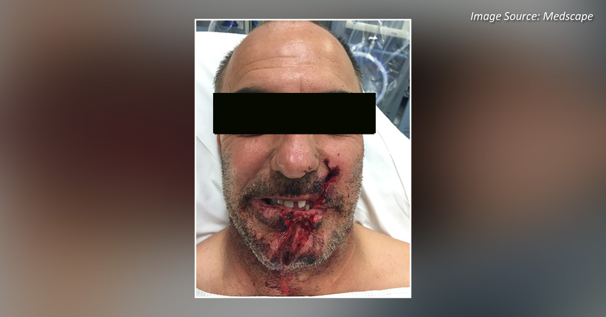 A Power Saw Cuts into a Man's Face