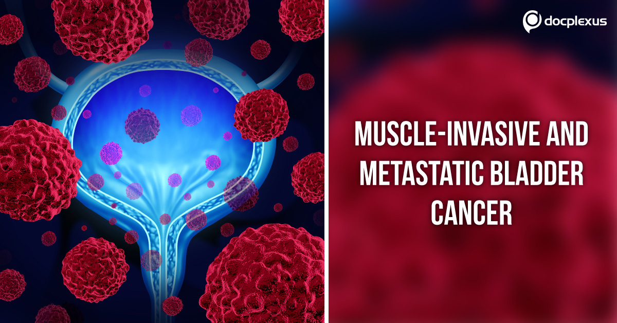 Muscle-Invasive and Metastatic Bladder Cancer: EAU Guidelines