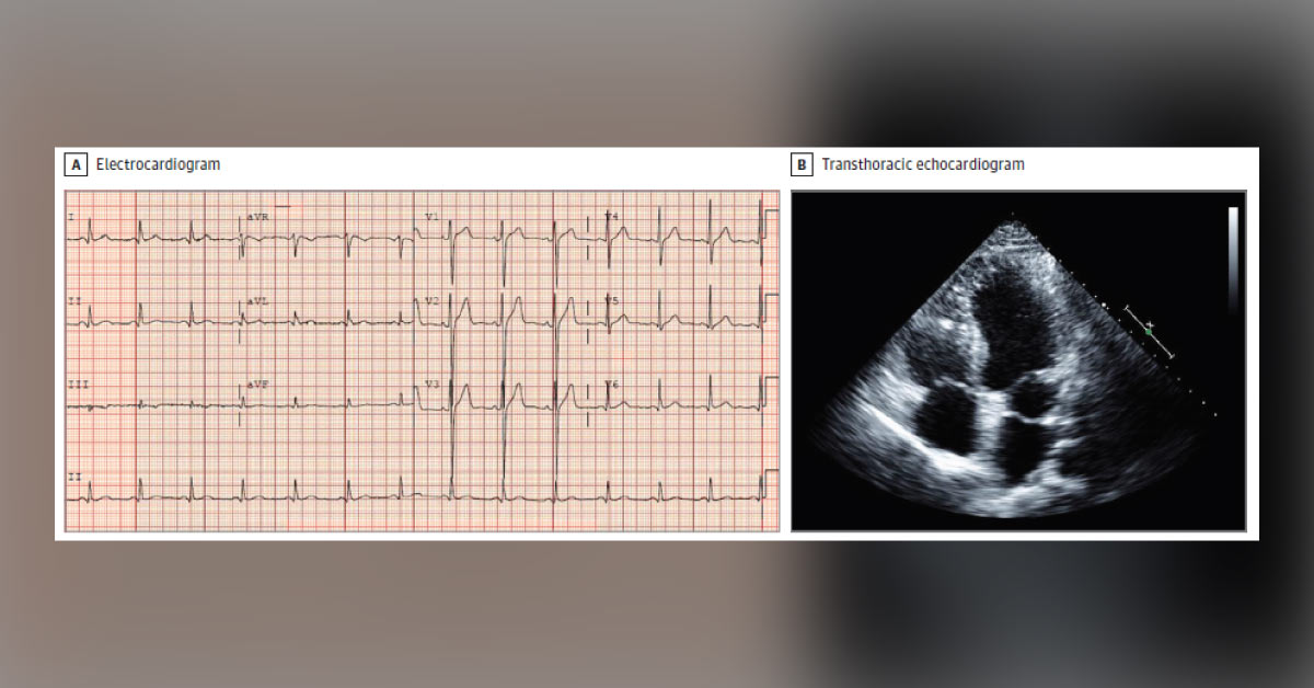 A Young Man with Recurrent Dyspnea and Palpitations
