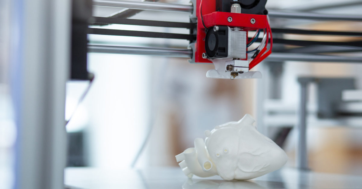 3D Printing: Guided Precise Surgery For Complex Pulmonary AV Malformation