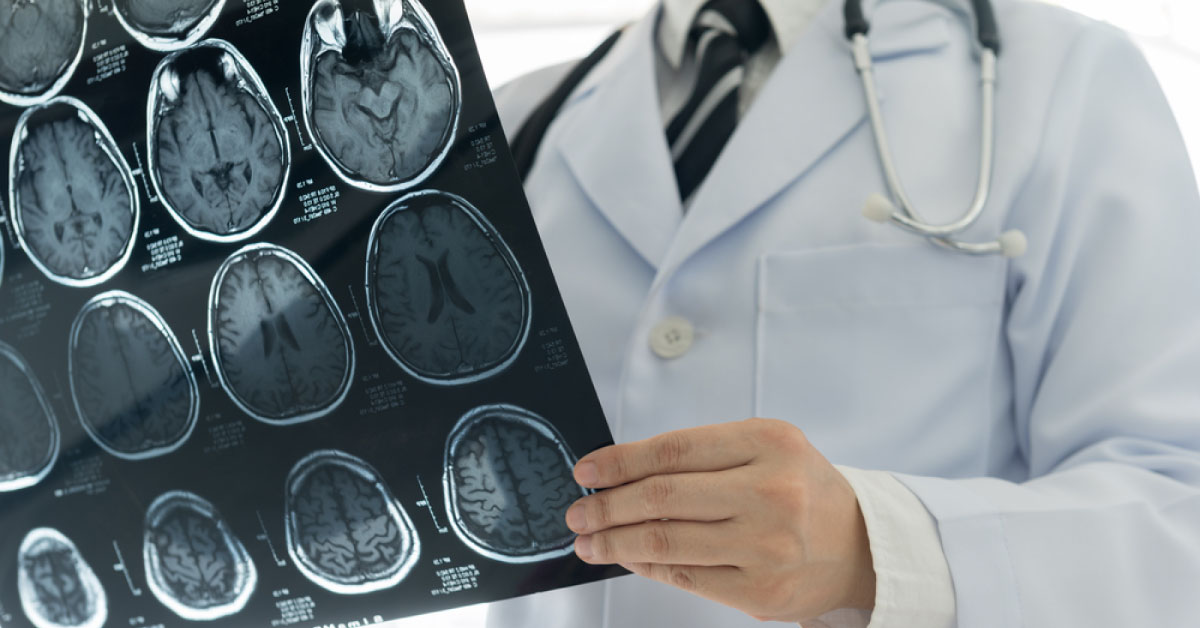 Minimizing Cognition Impairment In Radiation Therapy For Brain Metastasis