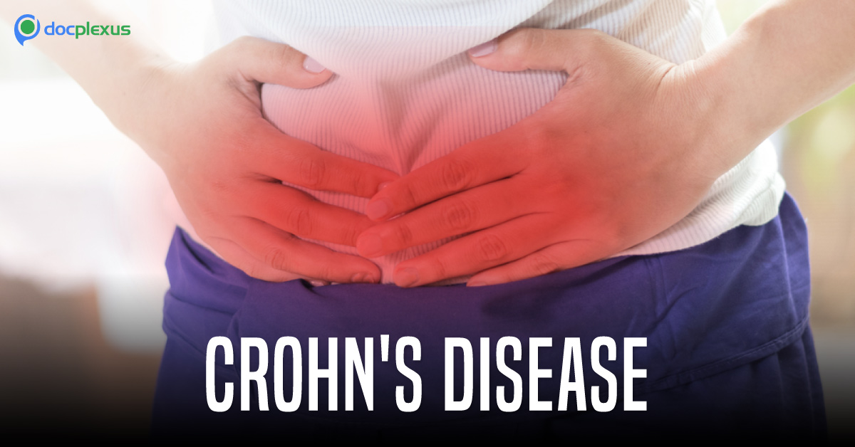 Relapse Prediction of Crohn’s Disease: Whom To Choose?