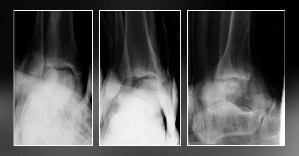 Spot The Diagnosis