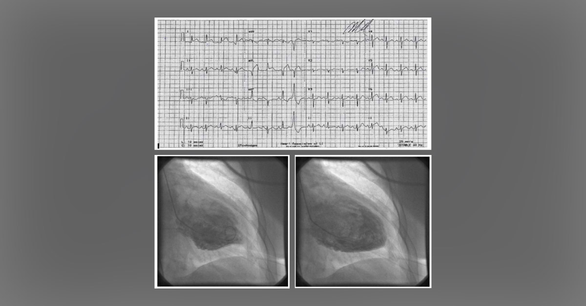 Spot the Abnormality in This Patient's Heart