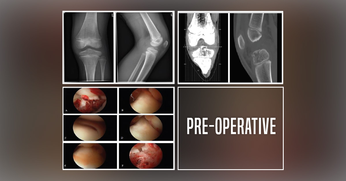 Combined Injury Sustained by Falls: What's Your Diagnosis?